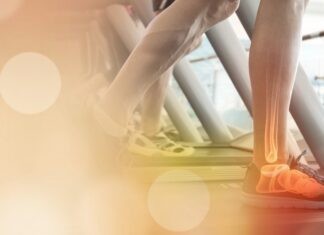 Laufband oder im Freien laufen?